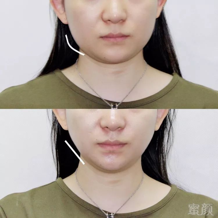 https://img.miyanlife.com/mnt/timg/181208/1312345C7-14.jpg