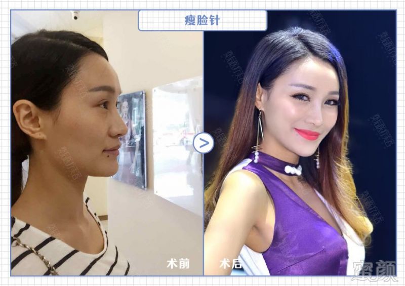 https://img.miyanlife.com/mnt/timg/181208/131Q41239-0.jpg