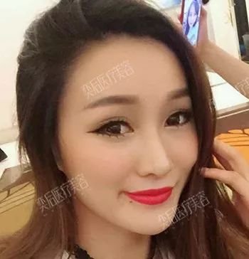 https://img.miyanlife.com/mnt/timg/181208/131Q424A-2.jpg