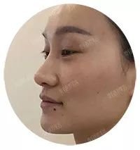 https://img.miyanlife.com/mnt/timg/181208/131Q42Y0-1.jpg