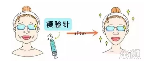 https://img.miyanlife.com/mnt/timg/181208/131Q53L7-6.jpg