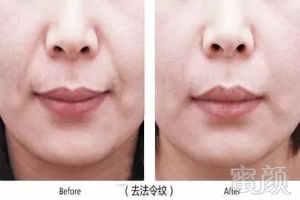 https://img.miyanlife.com/mnt/timg/181208/131QTc8-11.jpg