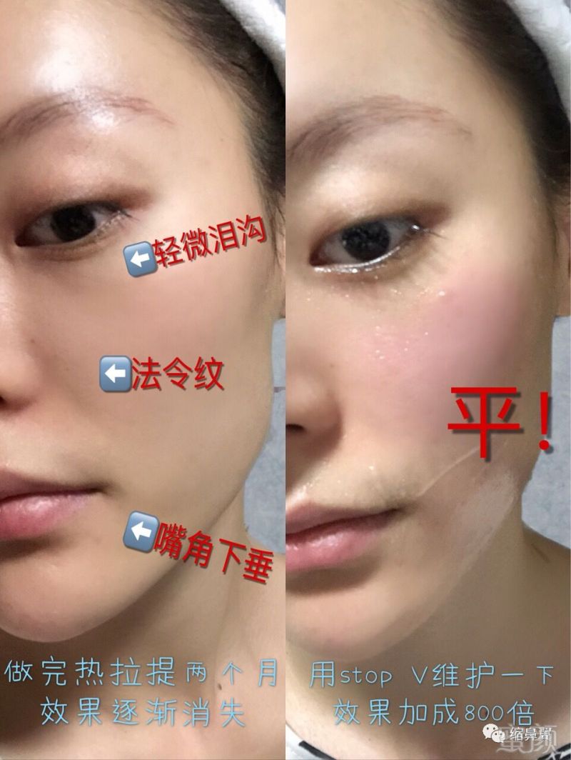 https://img.miyanlife.com/mnt/timg/181208/1325432W2-0.jpg