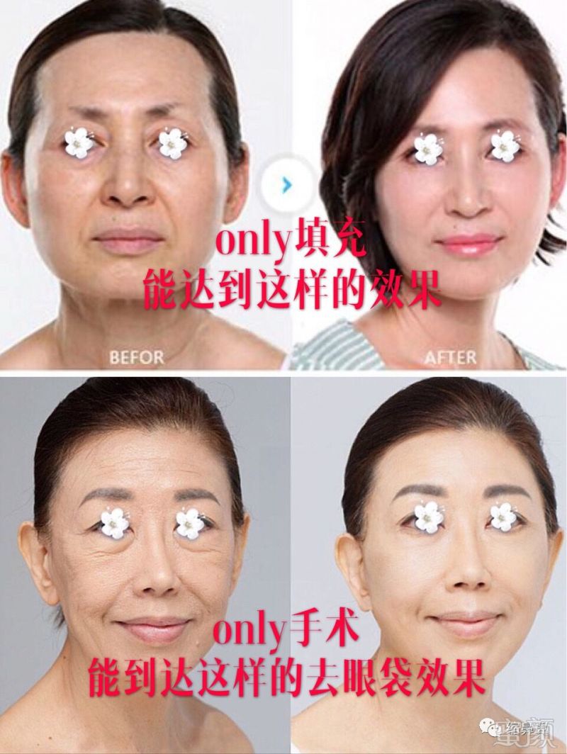 https://img.miyanlife.com/mnt/timg/181208/13254L4N-2.jpg