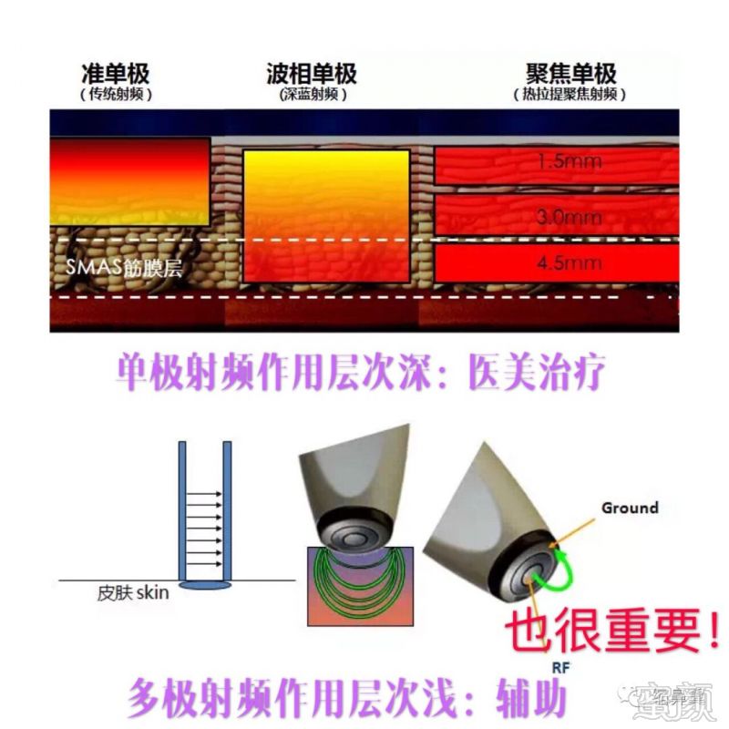 https://img.miyanlife.com/mnt/timg/181208/1325526100-4.jpg