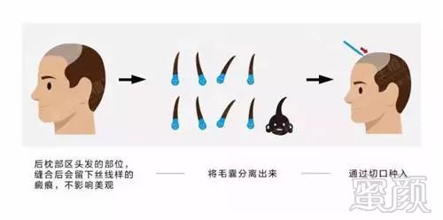 https://img.miyanlife.com/mnt/timg/181208/1351235a0-5.jpg