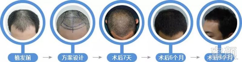 https://img.miyanlife.com/mnt/timg/181208/135123L55-3.jpg