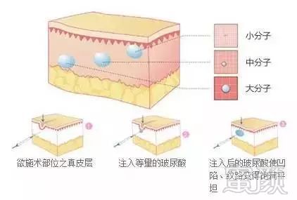 案例图片