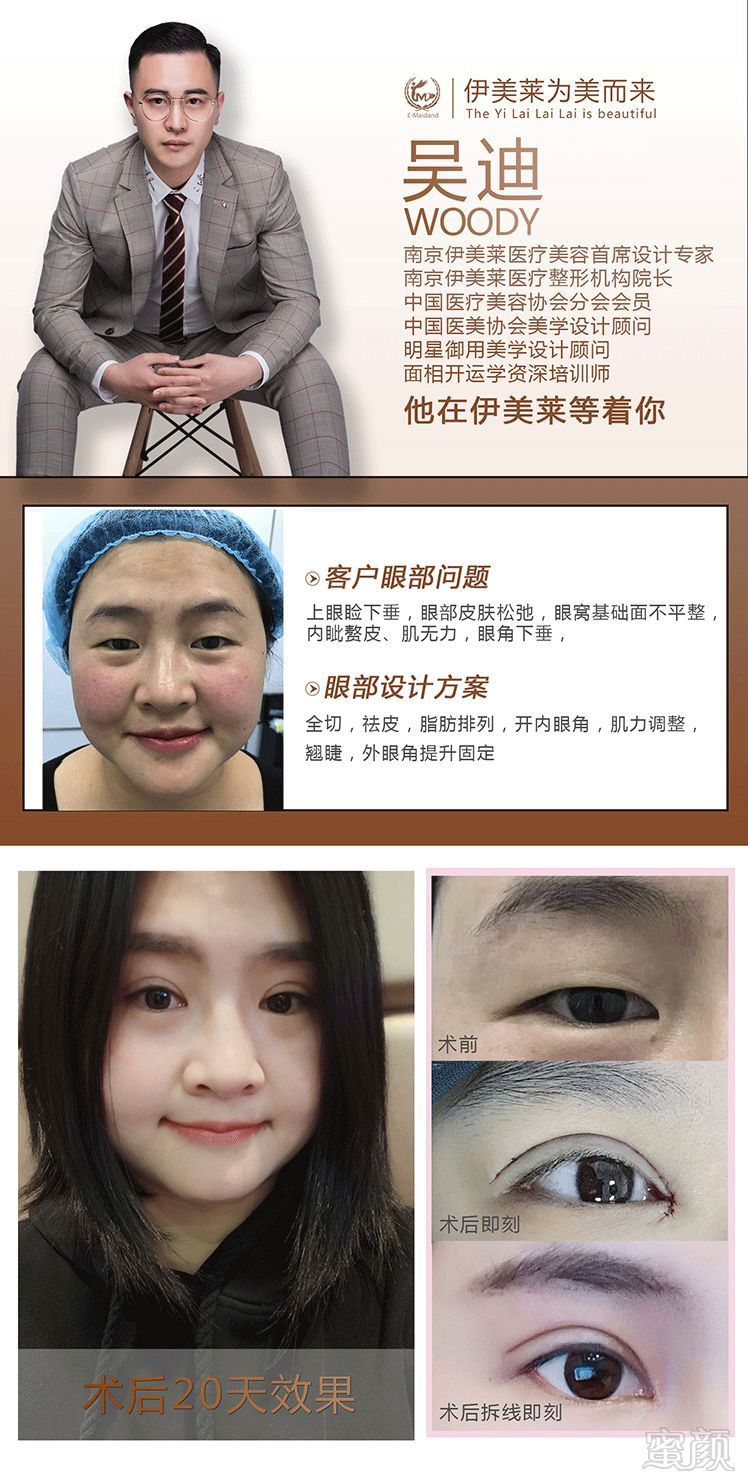 https://img.miyanlife.com/mnt/timg/181209/11432451D-0.jpg