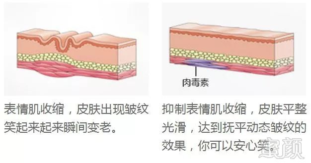 https://img.miyanlife.com/mnt/timg/181209/12045G020-6.jpg