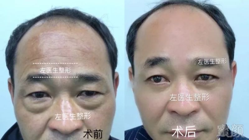 https://img.miyanlife.com/mnt/timg/181209/12045M1F-9.jpg