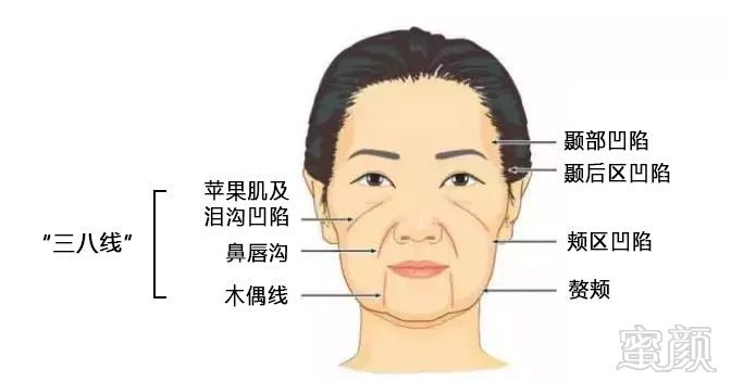 https://img.miyanlife.com/mnt/timg/181210/1236061a5-5.jpg