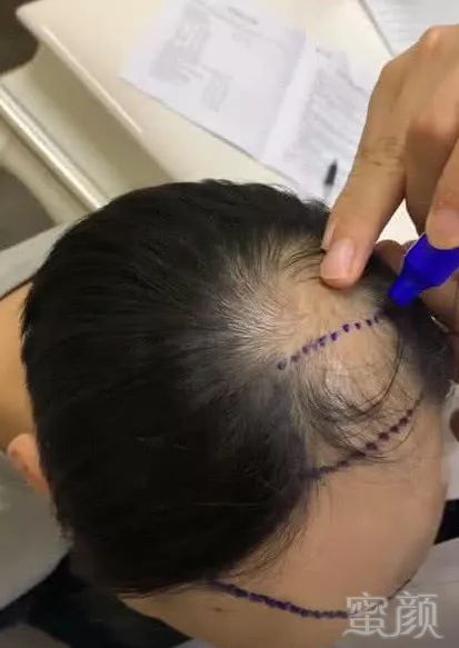 https://img.miyanlife.com/mnt/timg/181210/1320061633-1.jpg