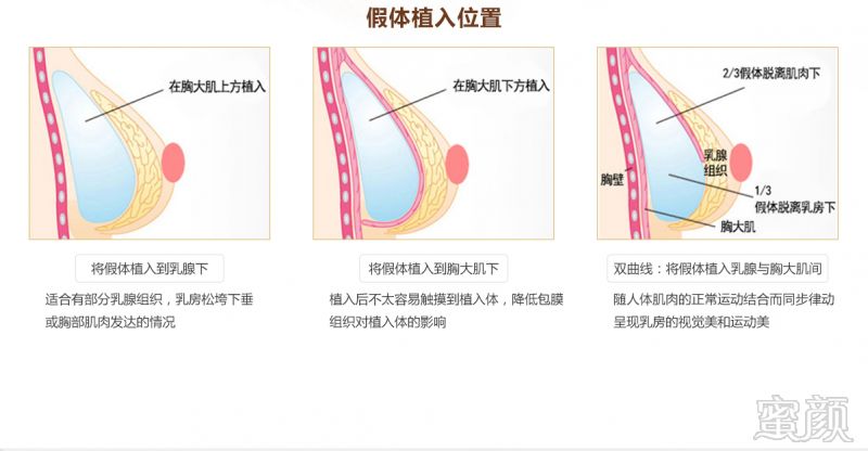 案例图片