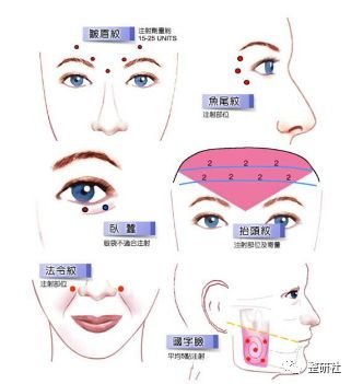 https://img.miyanlife.com/mnt/timg/181211/1159143X5-1.jpg