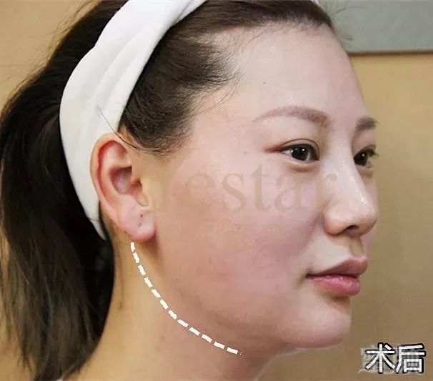 https://img.miyanlife.com/mnt/timg/181211/122R25437-13.jpg