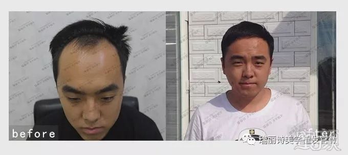 https://img.miyanlife.com/mnt/timg/181211/124220GD-3.jpg