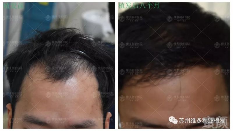 https://img.miyanlife.com/mnt/timg/181212/1215393140-1.jpg