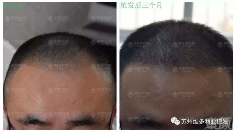 https://img.miyanlife.com/mnt/timg/181212/12153Q534-0.jpg