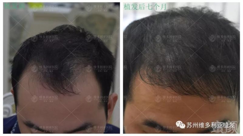 https://img.miyanlife.com/mnt/timg/181212/1215405330-4.jpg