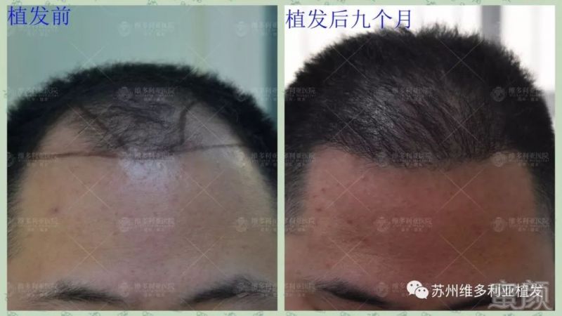https://img.miyanlife.com/mnt/timg/181212/121541C07-8.jpg