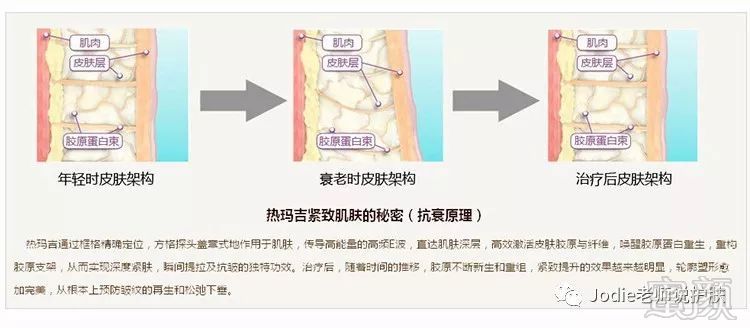 https://img.miyanlife.com/mnt/timg/181212/1240112332-5.jpg