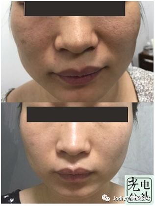 https://img.miyanlife.com/mnt/timg/181212/1240112607-6.jpg