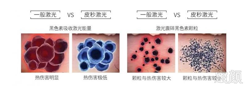 https://img.miyanlife.com/mnt/timg/181212/124I33244-3.jpg