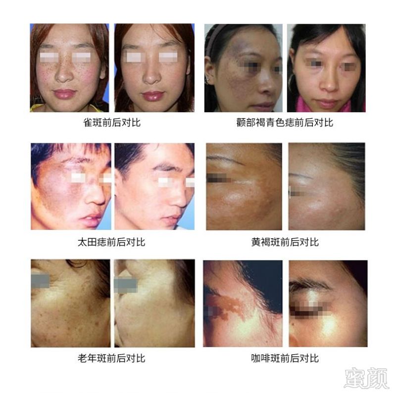 https://img.miyanlife.com/mnt/timg/181212/124I34V6-4.jpg
