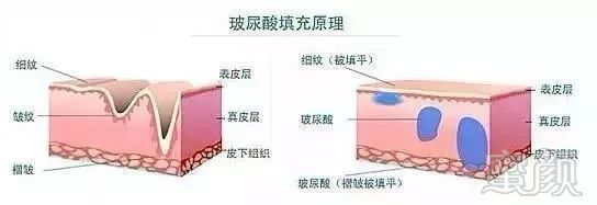https://img.miyanlife.com/mnt/timg/181213/120R34A8-0.jpg