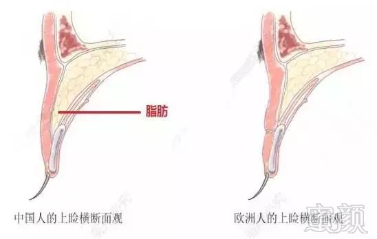 案例图片