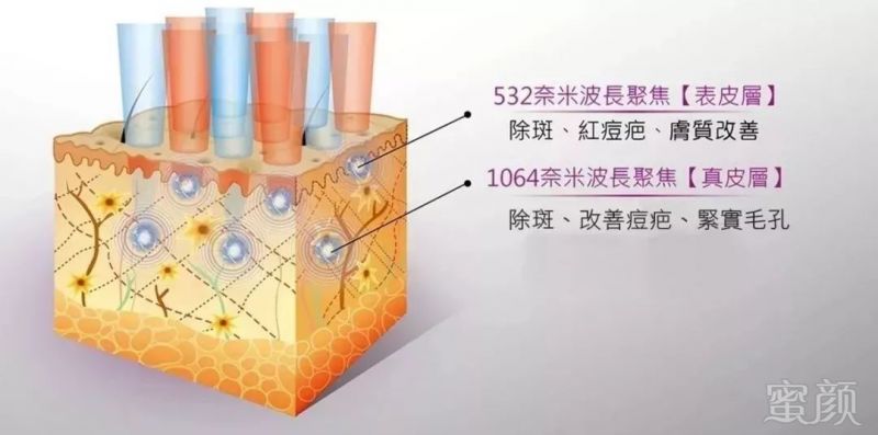 https://img.miyanlife.com/mnt/timg/181213/12355G924-8.jpg