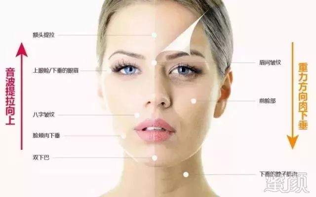 https://img.miyanlife.com/mnt/timg/181213/131F5B28-4.jpg