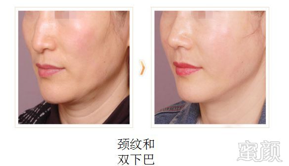 https://img.miyanlife.com/mnt/timg/181214/1054391047-5.jpg