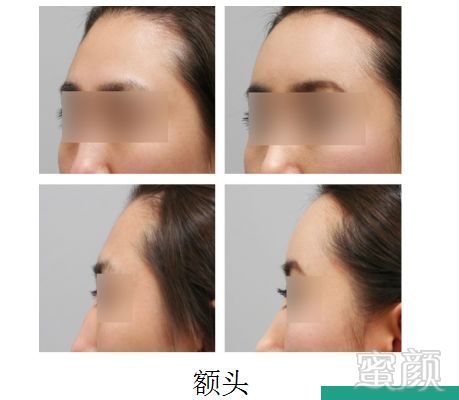 https://img.miyanlife.com/mnt/timg/181214/1054396456-6.jpg