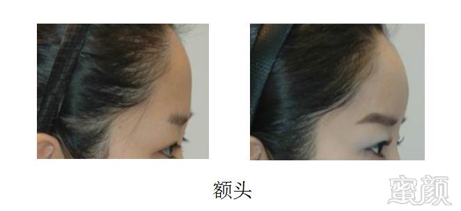 https://img.miyanlife.com/mnt/timg/181214/105439AO-4.jpg