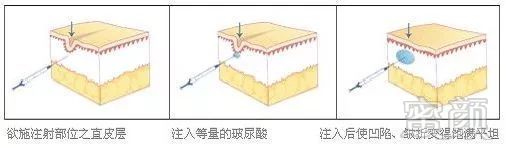 案例图片