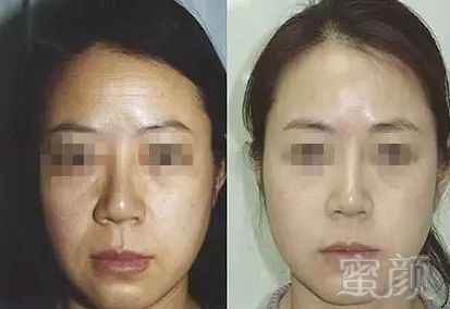 https://img.miyanlife.com/mnt/timg/181214/11000T553-7.jpg