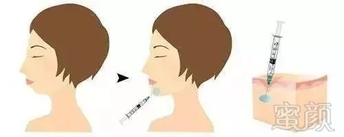 https://img.miyanlife.com/mnt/timg/181214/11352VS2-4.jpg