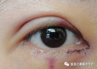 https://img.miyanlife.com/mnt/timg/181214/13024455V-4.jpg