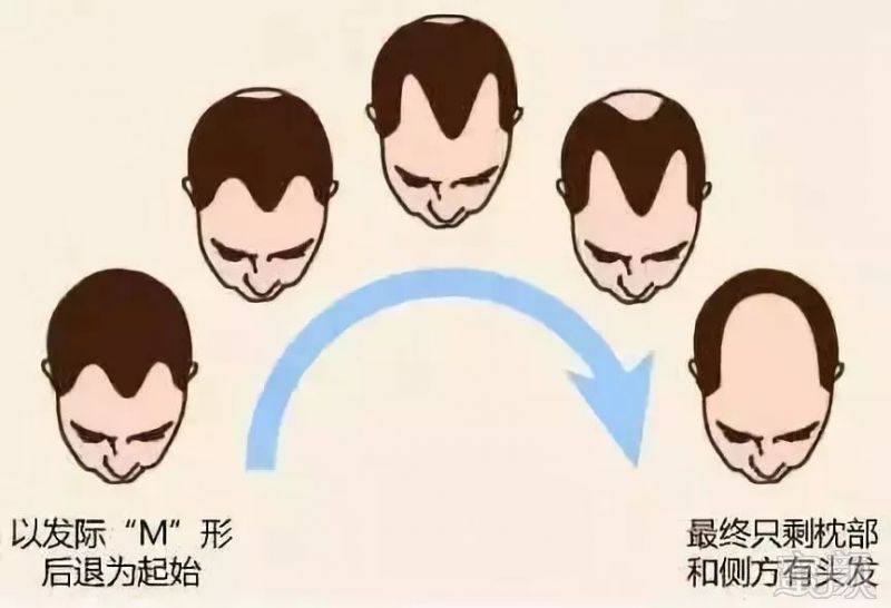https://img.miyanlife.com/mnt/timg/181216/1054543459-3.jpg