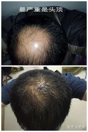 https://img.miyanlife.com/mnt/timg/181216/105I03D2-3.jpg