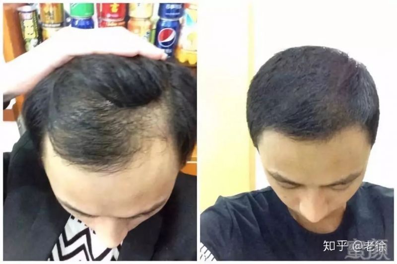 https://img.miyanlife.com/mnt/timg/181216/105I06350-5.jpg