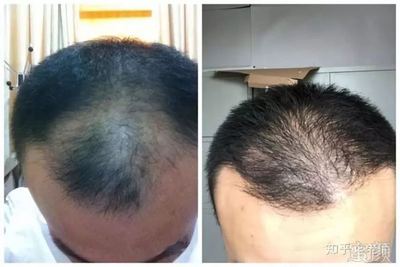 https://img.miyanlife.com/mnt/timg/181216/105I063C-4.jpg