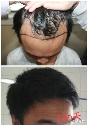https://img.miyanlife.com/mnt/timg/181216/105I0C60-7.jpg