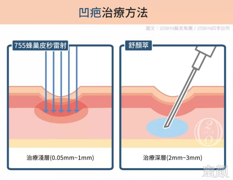 案例图片