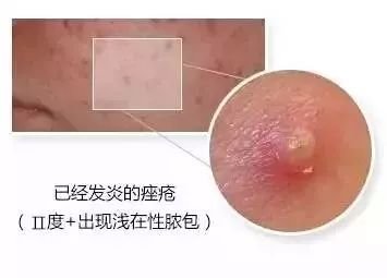https://img.miyanlife.com/mnt/timg/181216/1315442H9-13.jpg