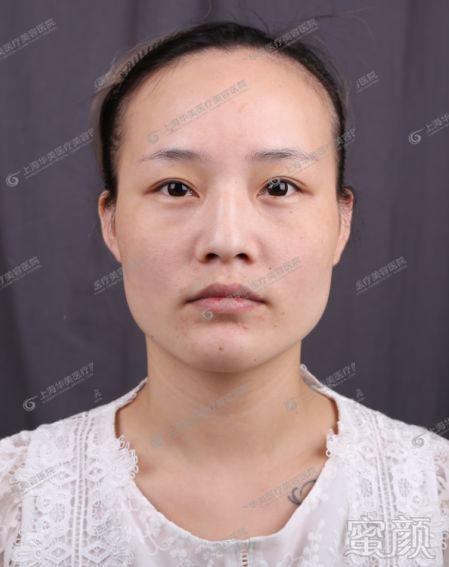 https://img.miyanlife.com/mnt/timg/181217/114HJ940-0.jpg