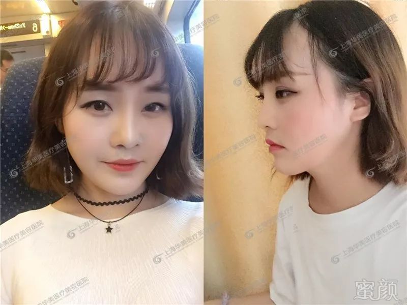 https://img.miyanlife.com/mnt/timg/181217/114HMT3-3.jpg