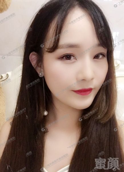 https://img.miyanlife.com/mnt/timg/181217/114HQ337-5.jpg
